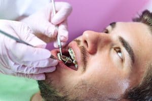 Adult Orthodontics Baton Rouge LA
