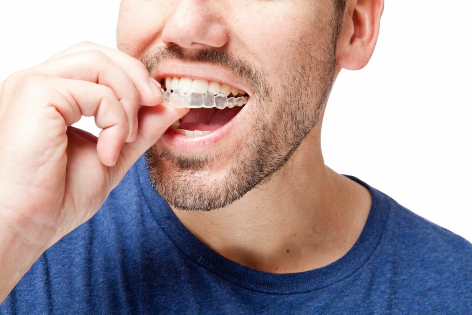 How to Clean Invisalign Aligners Properly? Porter Orthodontics in Baton Rouge, LA